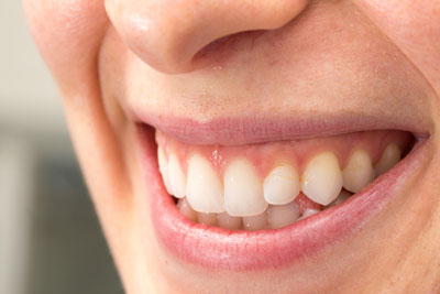 How CEREC Can Be Used to Restore Your Damaged Tooth