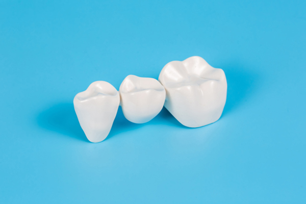 The Dental Bridge Procedure: A Step-By-Step Guide