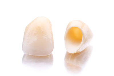 The Types of Dental Crowns