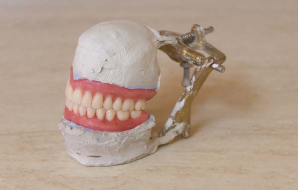 Poor Denture Care Habits to Avoid