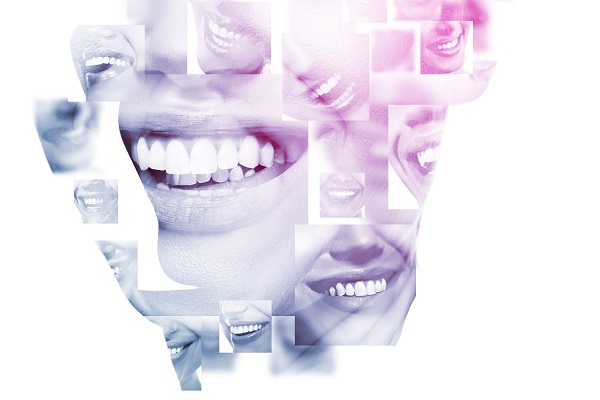 Restoring Oral Health and Esthetics Through a Full Mouth Reconstruction