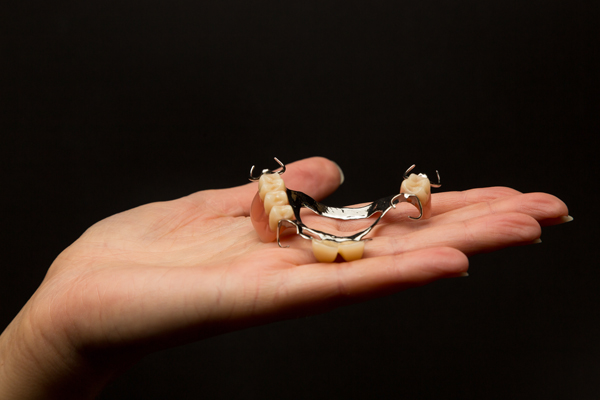 3 Options for Partial Dentures