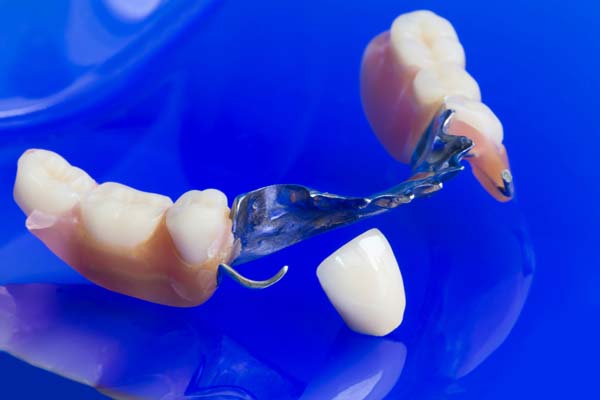 A Guide to Partial Dentures